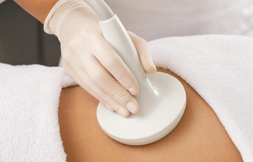 Ultrasound body-contouring applicator on a draped abdomen